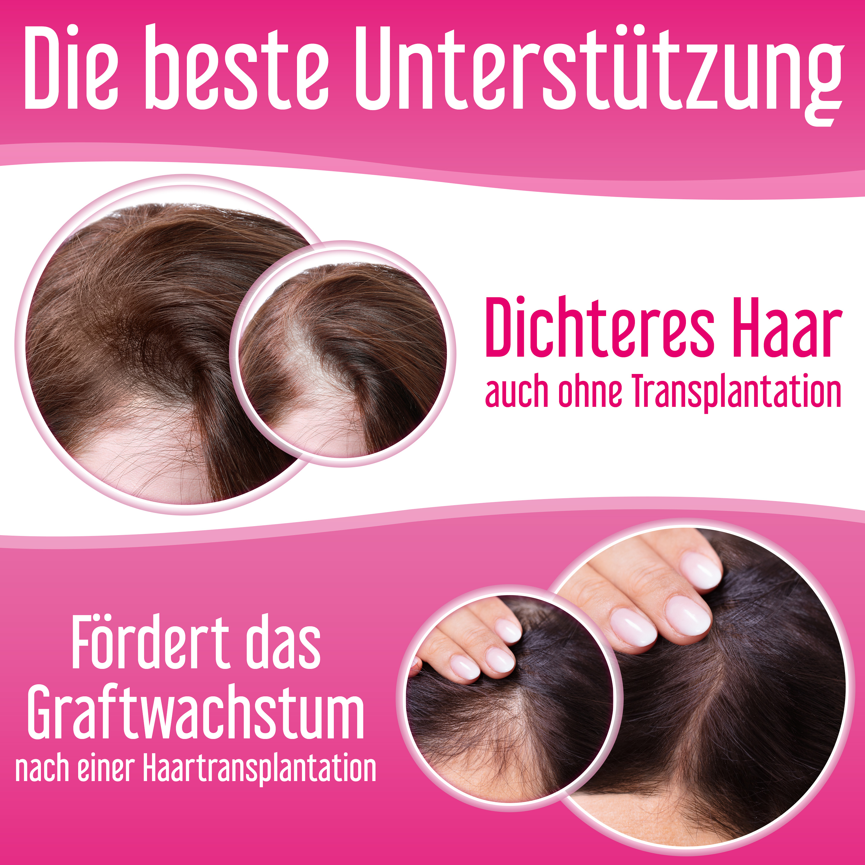 Anti Haarverlust Set. Xpecia + Hair Forte DHT Blocker Hair Growth Kit Frauen