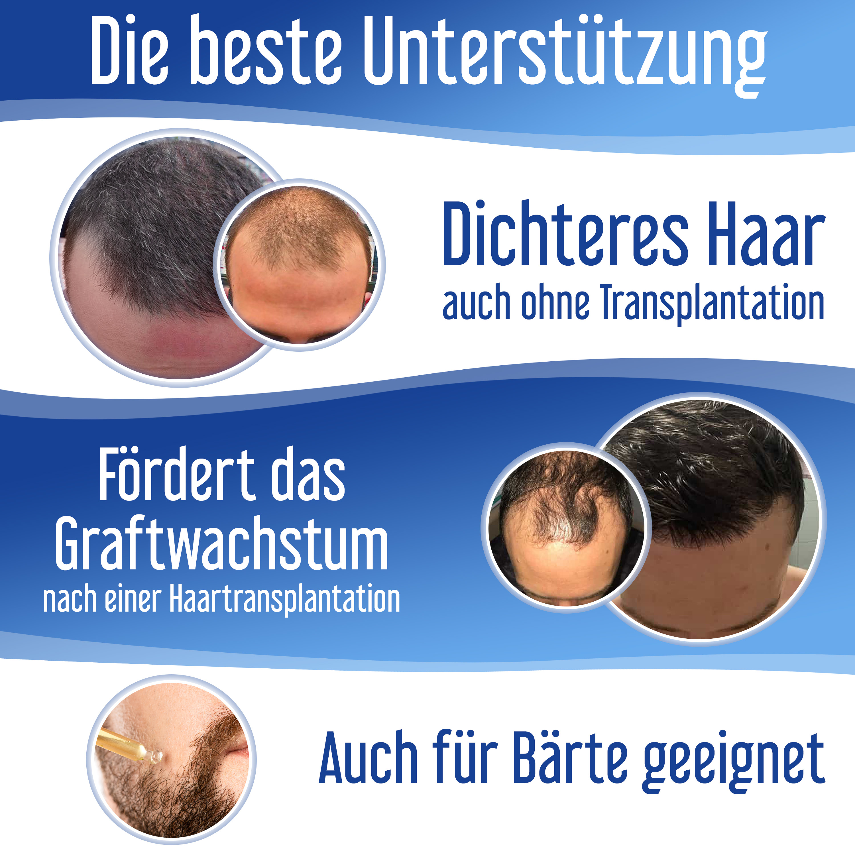 Hairforte Spray für Männer 3% Procapil gegen Haarverlust DHT Blocker