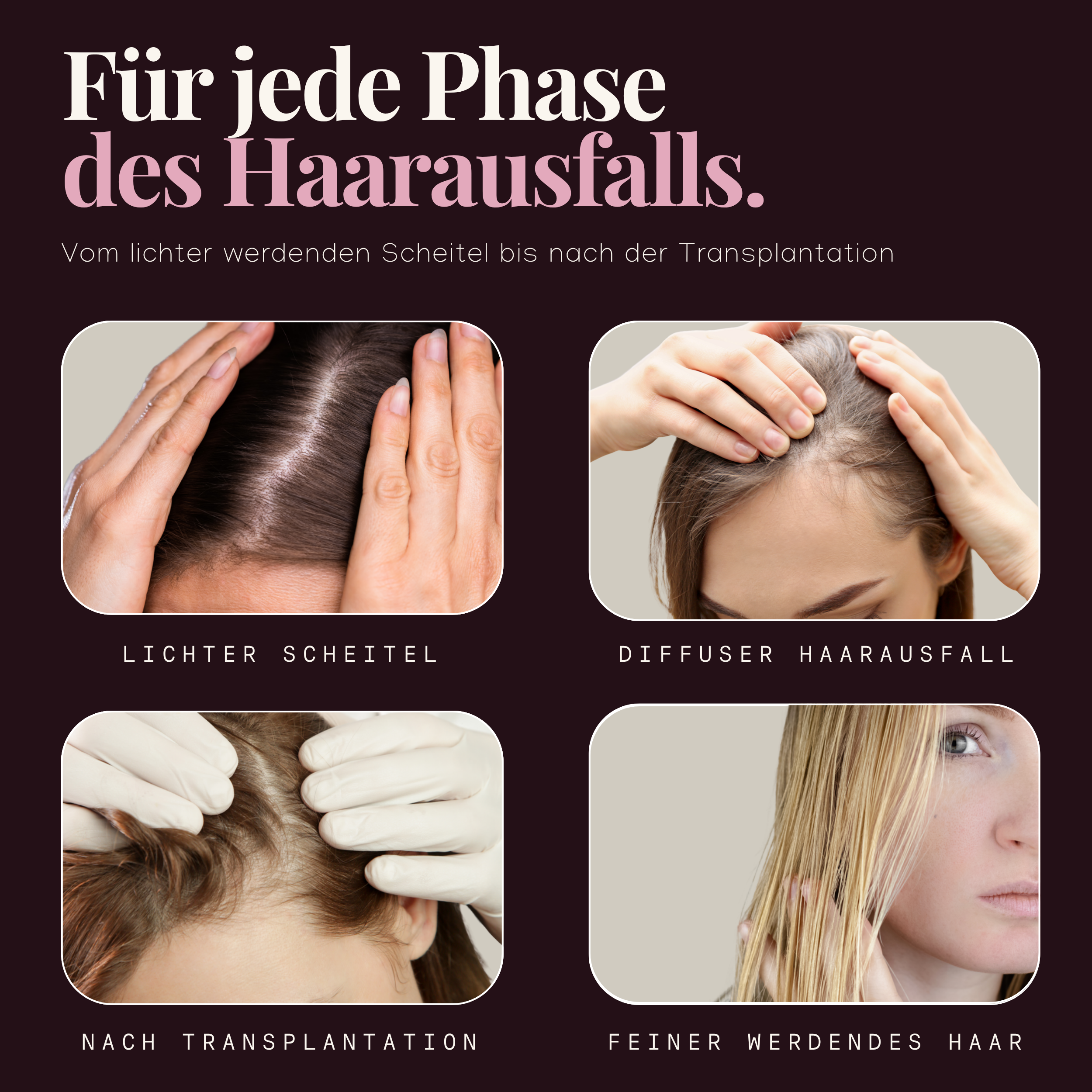 Spray Hairforte per Donna con il 2% di Procapil – Confezione Risparmio da 3, 3 x 60 ml