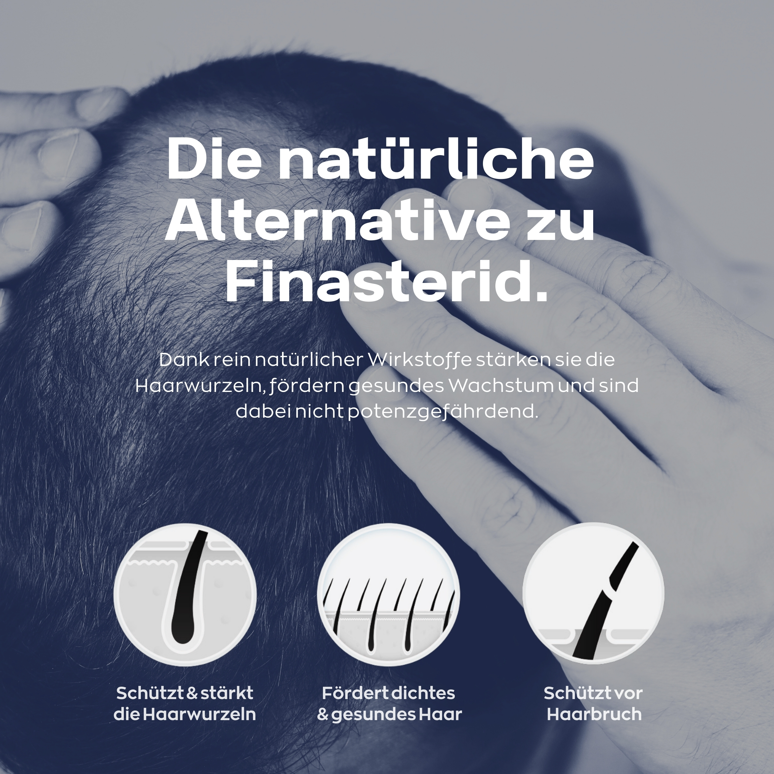 Xpecia Comprimés pour Homme – Complément Alimentaire à la Biotine et au Zinc pour vos Cheveux – 60 comprimés